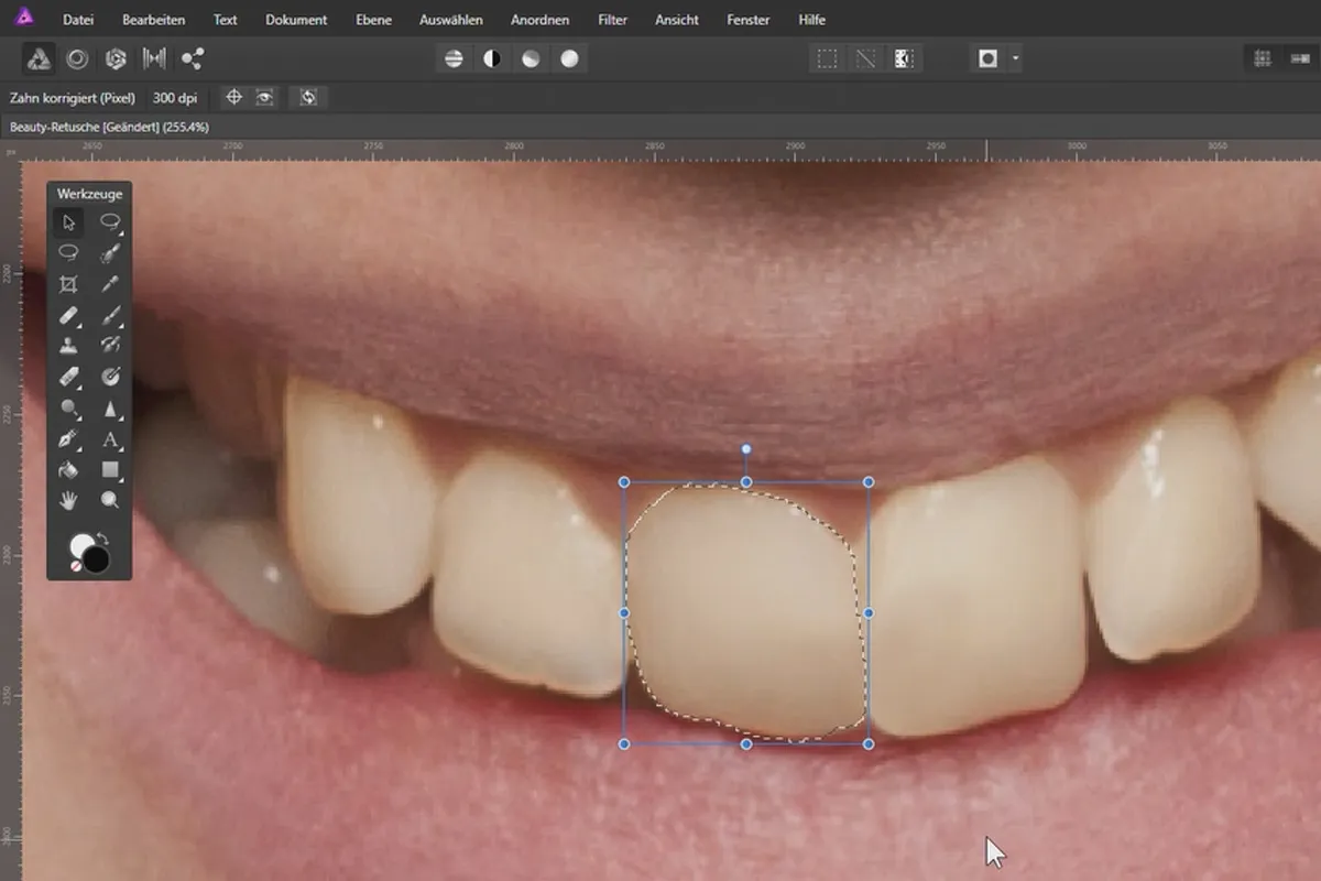 Corectare și înălbire a dinților în Affinity Photo: 07